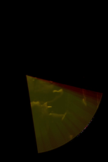 31145.2 (31145.2)