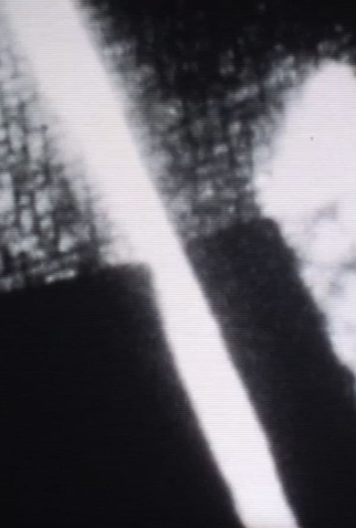 Poster 1 de Curta Slow Death (2000)