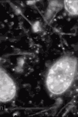 Anton van Leeuwenhoek (Antony van Leeuwenhoek)