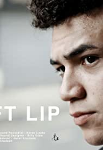 Cleft Lip (Cleft Lip)