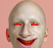 Face Lift