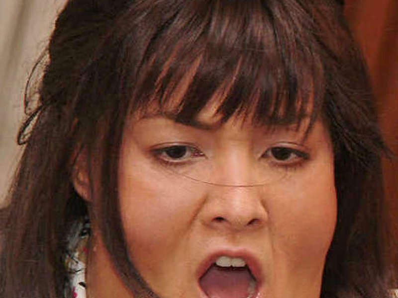 Foto 1 de Cholesterol Teerak