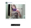 Cianose