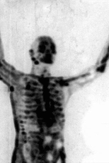 The Radio Wave of Blood Beneath the Dirt Ice and Flowers (在尘土，冰和花朵下的血波)