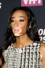 Winnie Harlow