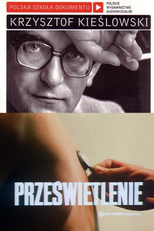 Raio-X (Przeswietlenie)