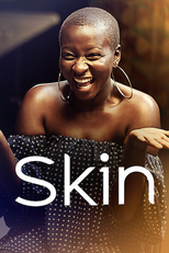 Skin (Skin)