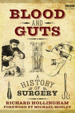 A História da Cirurgia - Por dentro do Cérebro (Blood And Guts: A History of Surgery)