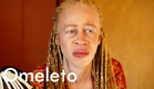 WHITE GOLD | Omeleto