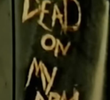 Dead On My Arm