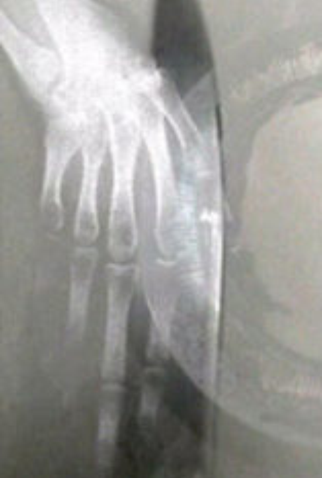 Poster 1 de Curta Embargo (1997)