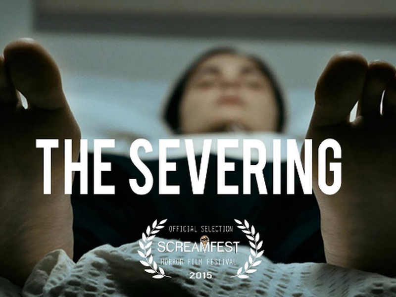 Foto 1 de The Severing