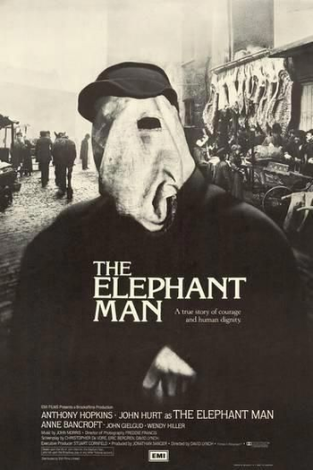  de Filme O Homem Elefante (1980)