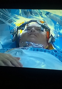 Cirurgia cerebral ao vivo (Brain surgery live)