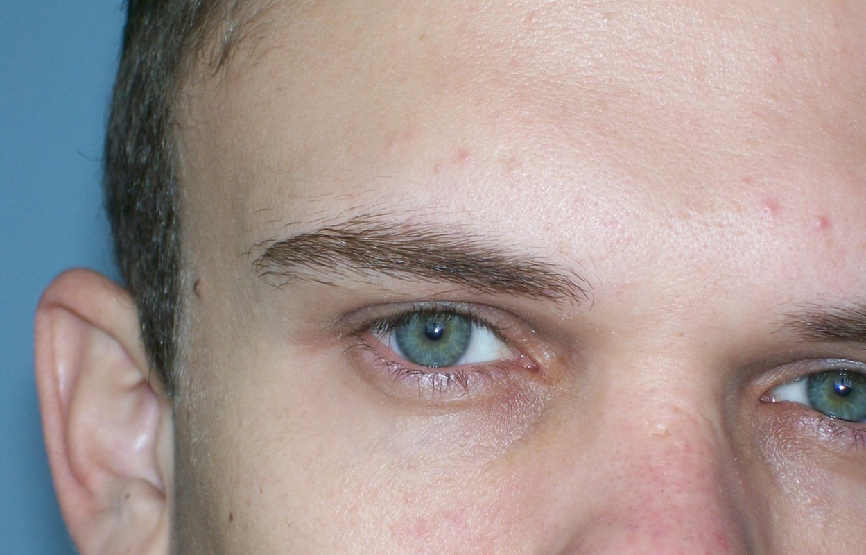 Alisson - Foto 1