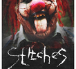 Stitches