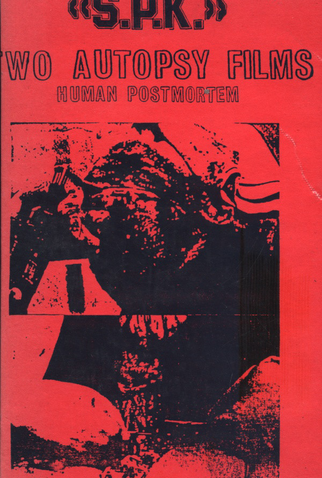Poster 1 de Filme S.P.K.: Two Autopsy Films: Human Postmortem (1983)