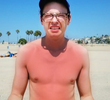 I got sunburnt...