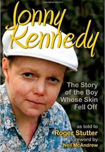The Boy Whose Skin Fell Off (The Boy Whose Skin Fell Off)