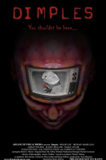 Dimples (Dimples)