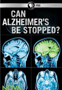 Can Alzheimer's Be Stopped? (Can Alzheimer's Be Stopped?)