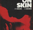 Skin on Skin