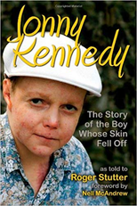 The Boy Whose Skin Fell Off (The Boy Whose Skin Fell Off)