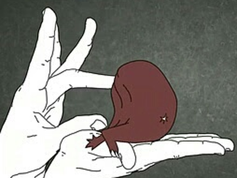 Foto 1 de Full-Body Prolapse