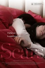 Scars (흉터)