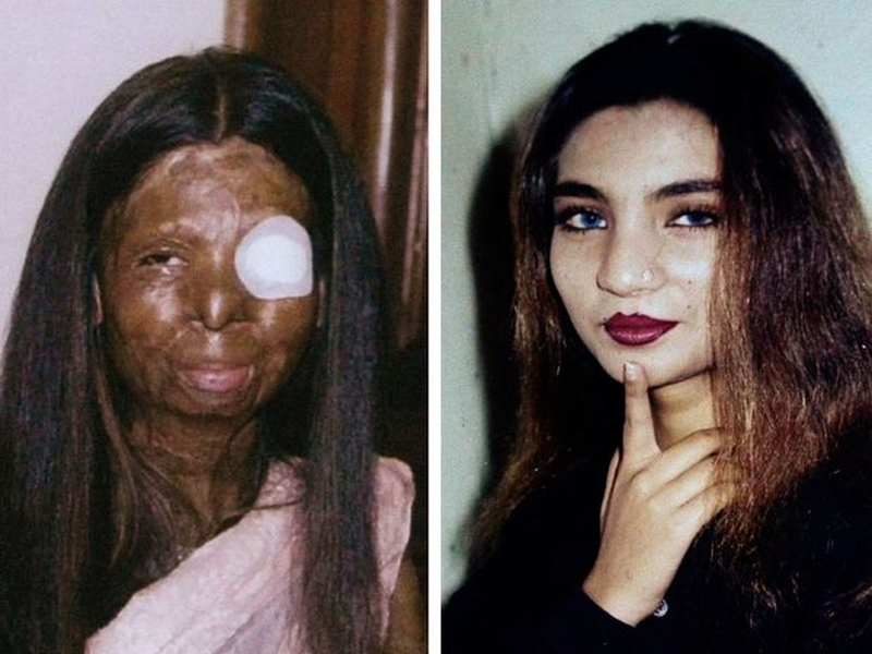 Foto 1 de Saving Face