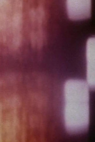 Poster 1 de Curta Bad Burns (1982)