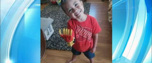 Menino de 3 anos de idade ganha prótese do “Homem de Ferro”