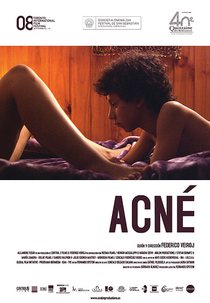 Acne (Acné)