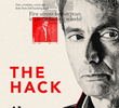 The Hack