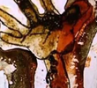 Phobia