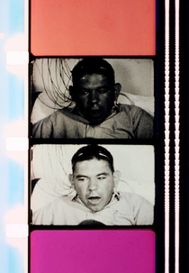 Epileptic Seizure Comparison (Epileptic Seizure Comparison)