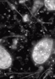 Anton van Leeuwenhoek (Antony van Leeuwenhoek)