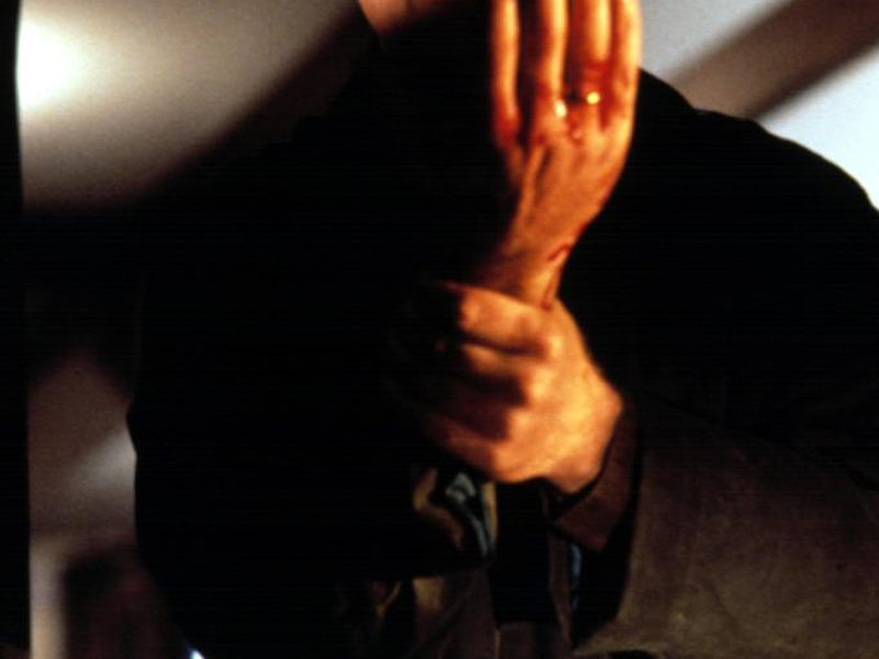 Foto 13 de Síndrome de Caim