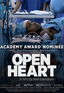 Open Heart (Open Heart)