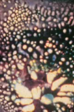 15 Days of Fever (15 Tage Fieber)