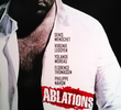 Ablations