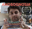 Anosognosia