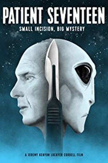 Poster de Filme Paciente Dezessete (2017)