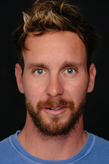 Tyler Nilson