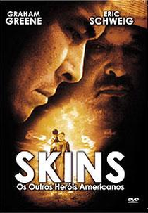 Skins- os outros heróis americanos (Skins- the other american heroes)