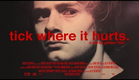 Short Film Trailer - Tick Where It Hurts - Bertie Gilbert - (BertiebertG)