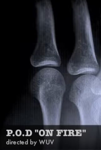 Poster 1 de Curta P.O.D.: On Fire (2011)