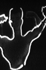 O Homem do Braço e o Braço do Homem (O Homem do Braço e o Braço do Homem)