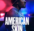 American Skin