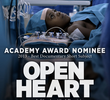 Open Heart